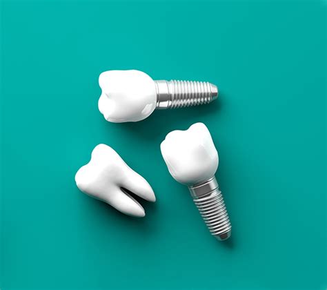 Dental Implants Torrey Hills Periodontal Group Periodontist San Diego Ca