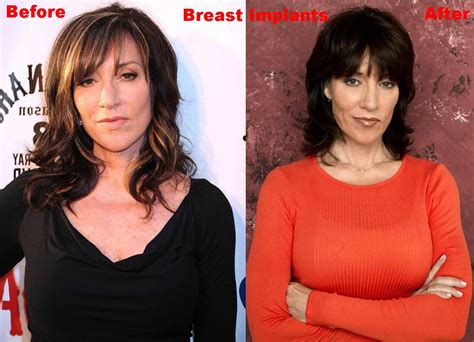 Katey Sagal Breast Implants Plastic Surgery Before And After Boobs Job Photos Plastic