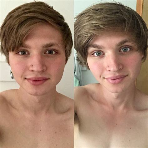 Mtf 2 F Transgender Hormones Telegraph