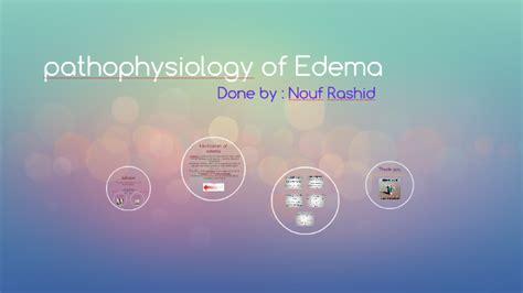 Pathophysiology Of Edema By Almarah1 Almarah1 On Prezi
