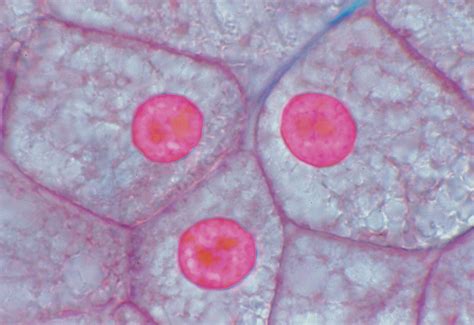 Plant Cell Nucleus Microscope