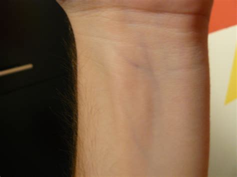 Fileimage Of A Wrist With Blue Veins Visible