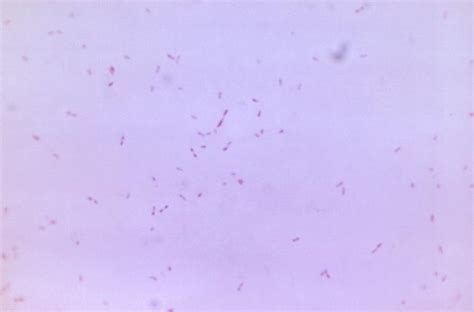 Fusobacterium Wikidoc