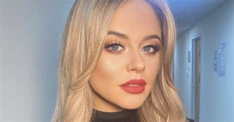 Emily Atack Reveals She Turned To Alcohol In Her Teens To Cope With