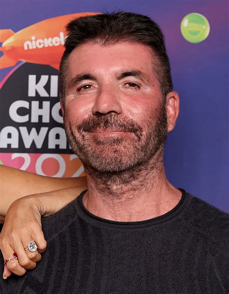 Simon Cowell Is Done With Botox And Fillers In His Face