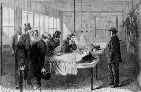10 Horrifying Medical Treatments From The 19th Century