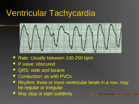 Defibrillation And Cardioversion Acls Ppt Powerpoint