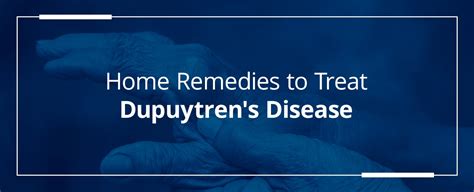 Home Remedies To Treat Dupuytrens Disease Orthobethesda