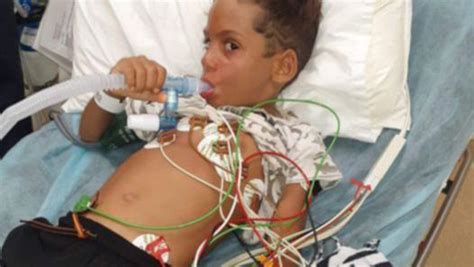 Broome Boy Carlos Dann Glauser Lucky To Survive After Deadly Irukandji