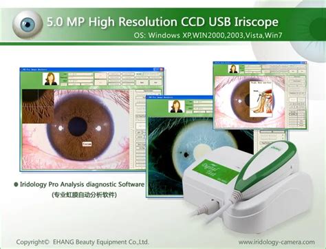 Iridoscopio Ocular Usb De 5 0mp Cámara De Iridología Analizador De Iris