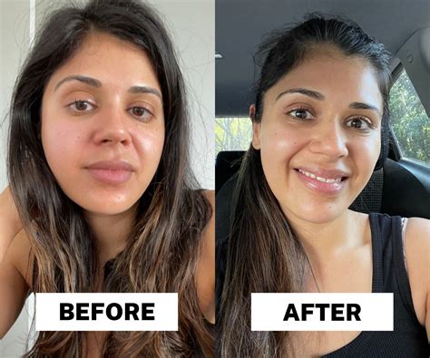 Exactly How I Fixed My Destroyed Skin Barrier In A Week