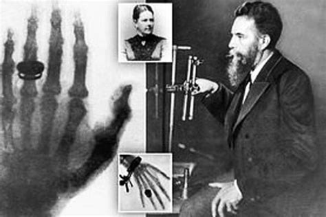 History Of X Ray Machine And Its Inventor Röntgen Custom X Ray