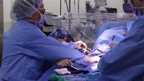 Focusing On You Reoperative Minimally Invasive Cardiac Surgery