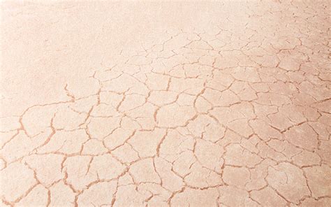 Ayurvedic Ways To Deal With Dry Skin In Summer Vedix