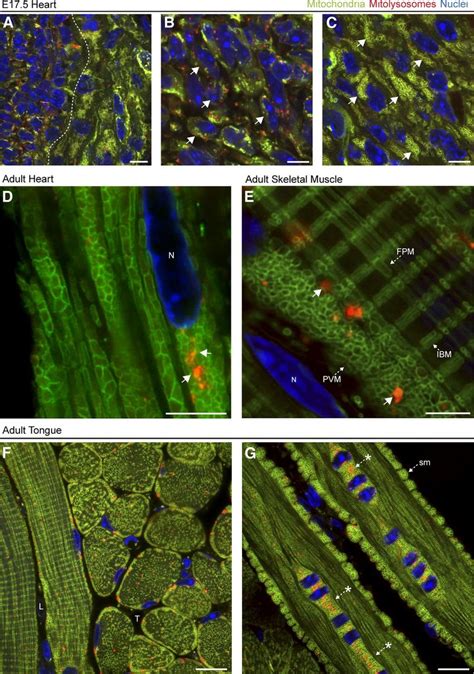 Tissue Wide Quantitation Of Mitophagy In Vivo Representative Images Of