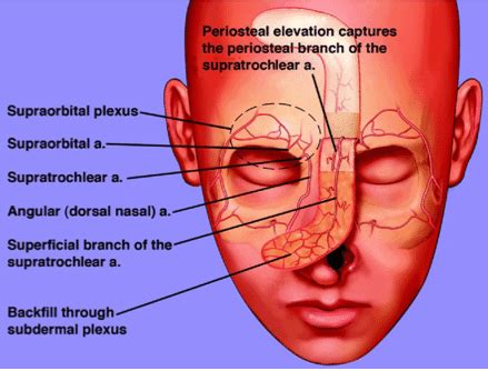Forehead Myocutaneous Flap The Use Of Tissue Expansion In Conjunction