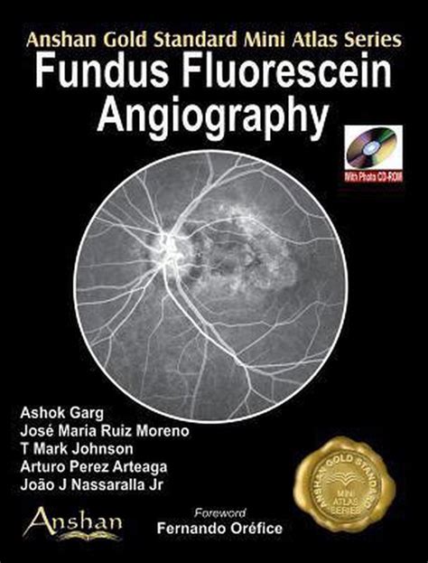 Mini Atlas Of Fundus Fluorescein Angiography