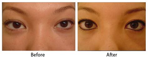 Permanent Makeup Before And After Photos Dr Sean Maguire