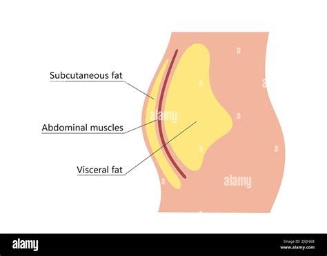 Visceral And Subcutaneous Fat Around Waistline Location Of Visceral Fat In Abdominal Cavity