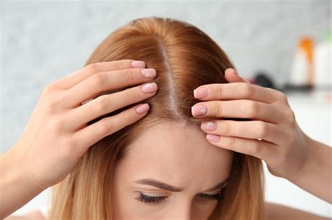 Poor scalp hygiene can also contribute to an increase in hair fall, he explained. How hair loss shampoos can help you with your baldness ...