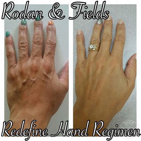 Look for products that contain. Worried about your aging hands? Worry no more. Check out ...