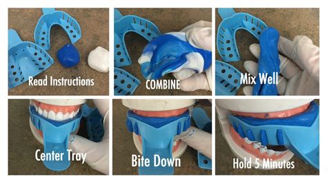 Diy denture kits include all the supplies and instructions needed to make your own dentures at home. DIY Denture Kit A2 Dental Impression Putty Cast Mold Upper ...