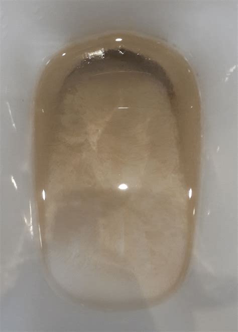 Transparent Growth In Toilet Bowl Growing From The Bottom And Sides It S Not A Film On Top Of