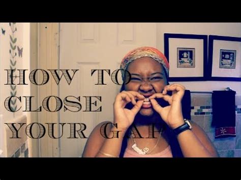 3.2 closing gaps between teeth without braces. HOW I CLOSED MY GAP WITHOUT BRACES | RANT - YouTube