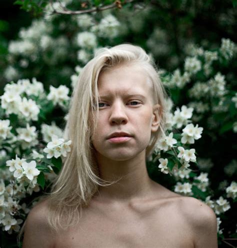 These Beautiful Albino People Are Simply Breathtaking Pics