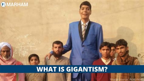 Gigantism 101 Symptoms Causes And Treatment Marham