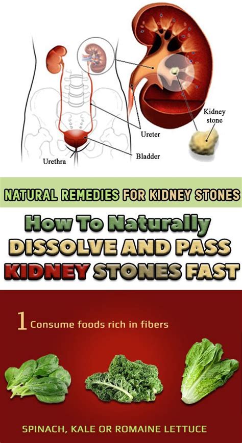 7 Best Herbs For Kidney Cleansing Kidney Stones Kidney Stones Remedy