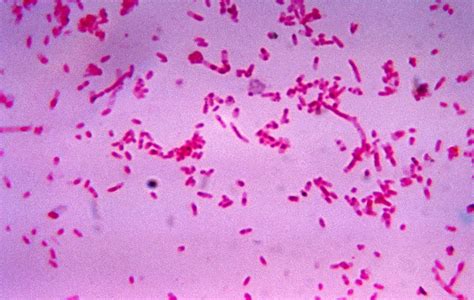 Gram Stain Tutorial Microbiology Learning The Whyology Of
