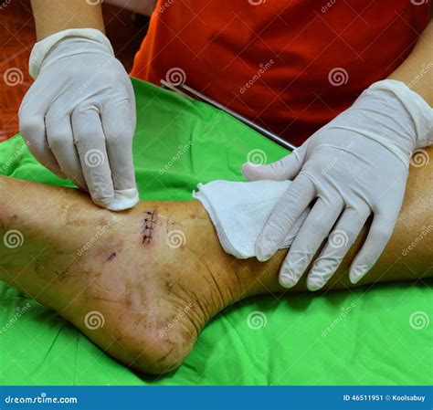 Dressing Wound Sutured Stock Image Image Of Stitches 46511951