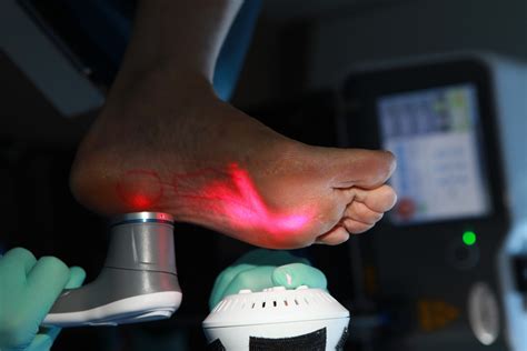 Laser Pain Therapy Ottawa Foot Clinic