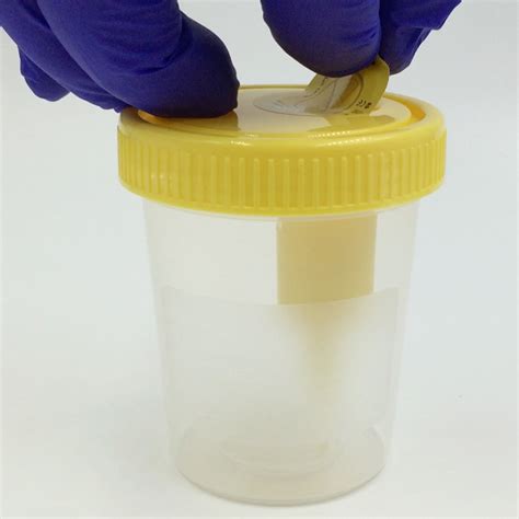 Urine Lab Specimen Containers Sterile Jars Cups Leakproof Id Label