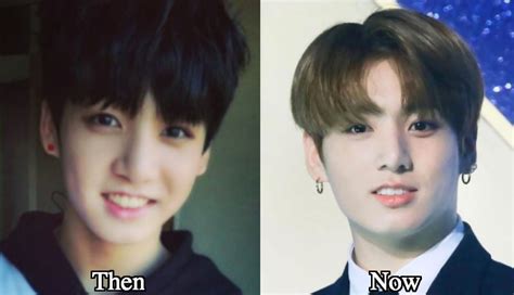 Jungkook Plastic Surgery Before And After Photos Latest Plastic