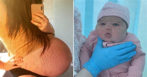Mum With Gigantic Baby Bump Gives Birth To Enormous 13lb Daughter