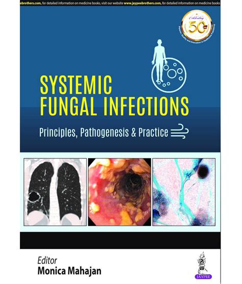 Systemic Fungal Infections Ubicaciondepersonascdmxgobmx