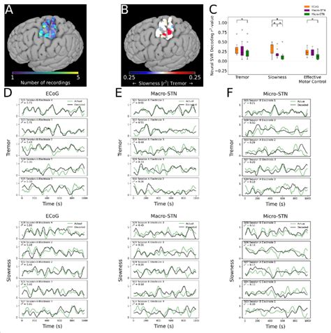 Cortical Tremor And Slowness Decoding Models Were Distributed