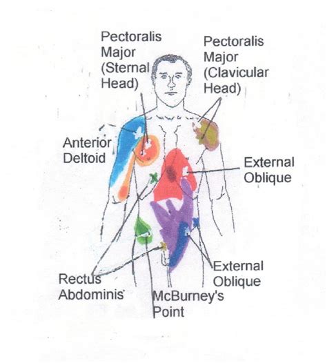Neck To Buttocks Front And Rear Trigger Point Chart 6 © Copyright