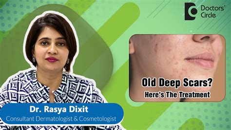 Treatment Of Deep Old Acne Scar For Clear Skin Acne Pimple Dr