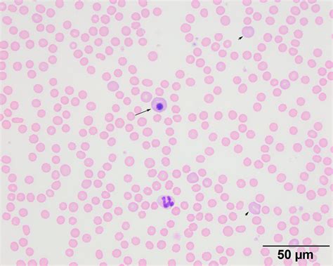 Figure 1 Blood Smear From A Dog With Mycoplasma Haemocanis Eclinpath