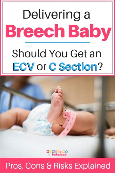 Turning A Breech Baby An External Cephalic Version Vs A C Section