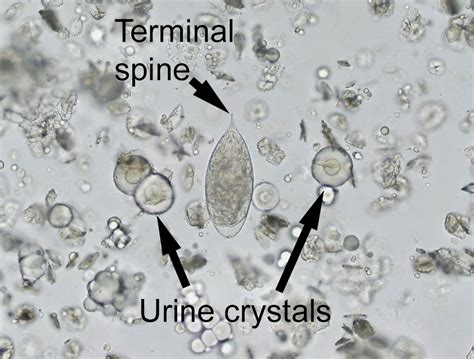 Creepy Dreadful Wonderful Parasites Answer To Case 309