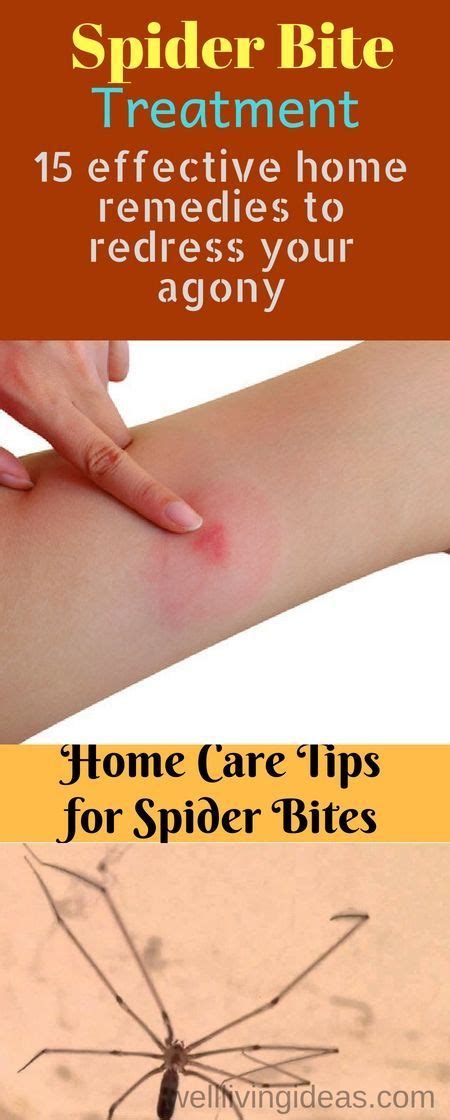 15 Home Remedies To Treat A Spider Bite Quickly At Home Spider Bites Spider Bite Treatment