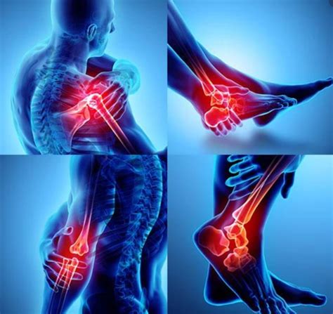 Tendon And Joint Pain