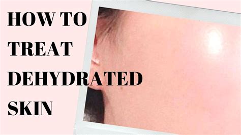 Dehydrated Skin Care Treatment Youtube
