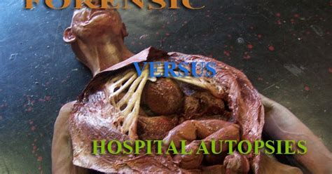 If it was government required, they will pay. Kenya Forensics Online Resource: FORENSIC VERSUS HOSPITAL ...