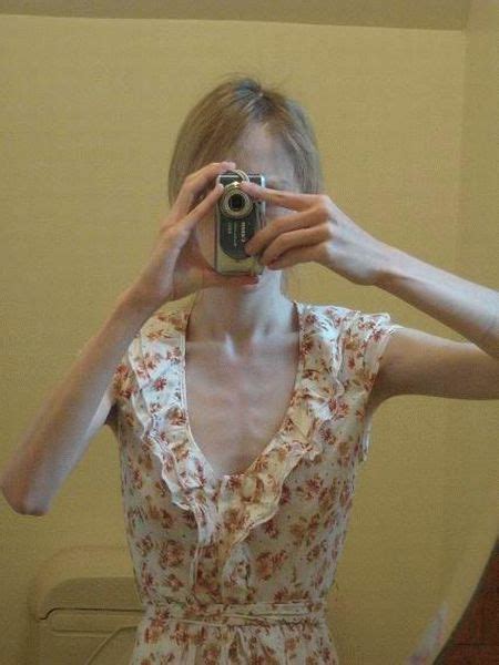 Funny And Weird Pictures Around The World Worlds Thinnest Body Caused