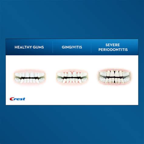 What Do Healthy Gums Look Like Crest